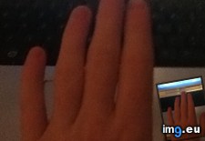 Tags: are, hands, normal (Pict. in My r/MILDLYINTERESTING favs)