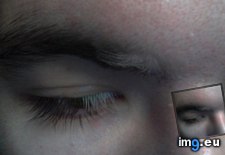 Tags: eyebrow, eyelashes, happening, losing, pigment (Pict. in My r/MILDLYINTERESTING favs)