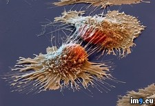 Tags: cancer, cells (Pict. in My r/PICS favs)