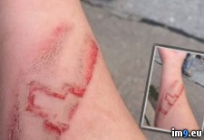 Tags: accident, arm, chevy, cut, friend, symbol (Pict. in My r/PICS favs)