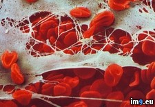 Tags: immune, system (Pict. in My r/PICS favs)