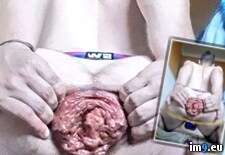 Tags: destroyed, prolapse, faggot, gay, wide, gape, horny, perverted, porn, analgape, gaped, prolapsed, dickless, ass, loser, hardcore, assgape, fag (Pict. in Faggot Jackeager2)