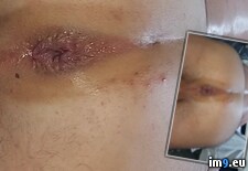 Tags: cock, dick, fag, filthy, fuckhole, gay, gayasshole, hardcore, pig, porn, videocapture, xxx (Pict. in Boy sexy)