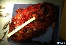 Tags: due, kidneys, one, pkd, removed, ruler, scale, wtf (Pict. in My r/WTF favs)