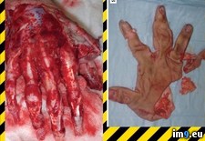 Tags: finger, gloves, gore, nsfl, wtf (Pict. in My r/WTF favs)
