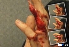 Tags: degloved, finger, gif, wtf (GIF in My r/WTF favs)