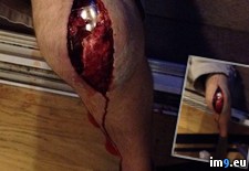 Tags: falls, guy, knee, replacement, revealing, scar, splits, wtf (Pict. in My r/WTF favs)