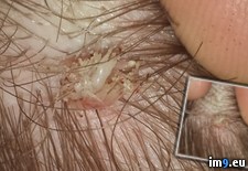 Tags: asked, bump, head, husband, new, tick, wasn, wtf (Pict. in My r/WTF favs)