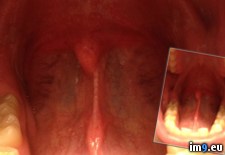 Tags: swallow, tongue, wtf (Pict. in My r/WTF favs)