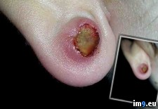 Tags: ear, exploded, wtf (Pict. in My r/WTF favs)
