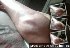 Tags: cramps, leg, wtf (GIF in My r/WTF favs)