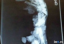 Tags: arm, grinder, meat, scary, sfw, wtf, xray (Pict. in My r/WTF favs)