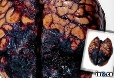 Tags: album, medicine, wtf (Pict. in My r/WTF favs)