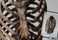 Tags: album, medicine, wtf (Pict. in My r/WTF favs)