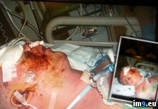 Tags: album, eye, friend, lost, wtf (Pict. in My r/WTF favs)