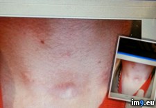 Tags: album, eye, friend, lost, wtf (Pict. in My r/WTF favs)