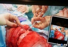 Tags: album, eye, friend, lost, wtf (Pict. in My r/WTF favs)