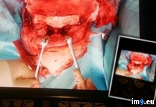 Tags: album, eye, friend, lost, wtf (Pict. in My r/WTF favs)