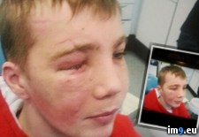 Tags: album, eye, friend, lost, wtf (Pict. in My r/WTF favs)