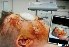 Tags: album, eye, friend, lost, wtf (Pict. in My r/WTF favs)