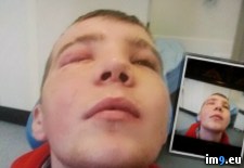 Tags: album, eye, friend, lost, wtf (Pict. in My r/WTF favs)