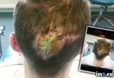 Tags: album, eye, friend, lost, wtf (Pict. in My r/WTF favs)