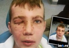Tags: album, eye, friend, lost, wtf (Pict. in My r/WTF favs)