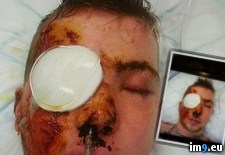 Tags: album, eye, friend, lost, wtf (Pict. in My r/WTF favs)