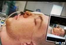 Tags: album, eye, friend, lost, wtf (Pict. in My r/WTF favs)