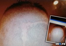 Tags: album, eye, friend, lost, wtf (Pict. in My r/WTF favs)