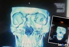 Tags: album, eye, friend, lost, wtf (Pict. in My r/WTF favs)