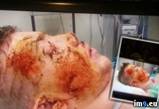 Tags: album, eye, friend, lost, wtf (Pict. in My r/WTF favs)