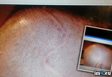 Tags: album, eye, friend, lost, wtf (Pict. in My r/WTF favs)