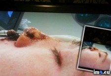 Tags: album, eye, friend, lost, wtf (Pict. in My r/WTF favs)