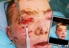 Tags: album, eye, friend, lost, wtf (Pict. in My r/WTF favs)