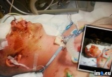 Tags: album, eye, friend, lost, wtf (Pict. in My r/WTF favs)