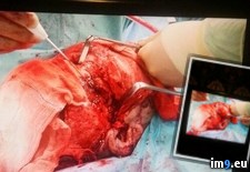 Tags: album, eye, friend, lost, wtf (Pict. in My r/WTF favs)