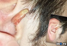 Tags: crazy, ear, infection, wtf (Pict. in My r/WTF favs)