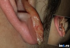 Tags: crazy, ear, infection, wtf (Pict. in My r/WTF favs)