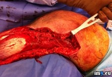 Tags: fasciitis, friend, had, necrotizing, stepdad, wtf (Pict. in My r/WTF favs)