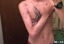Tags: arm, car, day, happened, left, months, wreck, wtf (Pict. in My r/WTF favs)