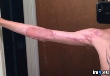 Tags: arm, car, day, happened, left, months, wreck, wtf (Pict. in My r/WTF favs)