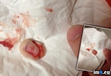 Tags: 20th, birthday, finger, lost, pals, ring, wtf (Pict. in My r/WTF favs)