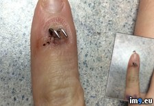 Tags: broken, finger, pinky, wife, wtf (Pict. in My r/WTF favs)