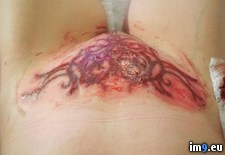 Tags: bruised, commiseration, girl, lady, parts, wtf (Pict. in My r/WTF favs)