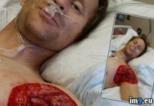 Tags: ago, boulder, couple, hiking, injuries, one, run, weekends, wtf (Pict. in My r/WTF favs)