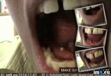 Tags: erupts, guys, nsfl, pimple, popping, tongue, wtf, xpost (GIF in My r/WTF favs)