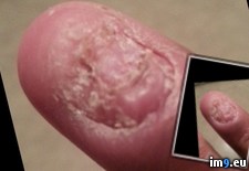 Tags: ago, fingernail, off, regrowth, ripped, wtf (Pict. in My r/WTF favs)