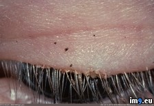 Tags: eyelashes, lice, pubic, wtf, you (Pict. in My r/WTF favs)