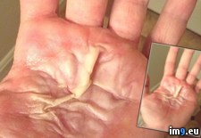 Tags: stabbed, wtf (Pict. in My r/WTF favs)